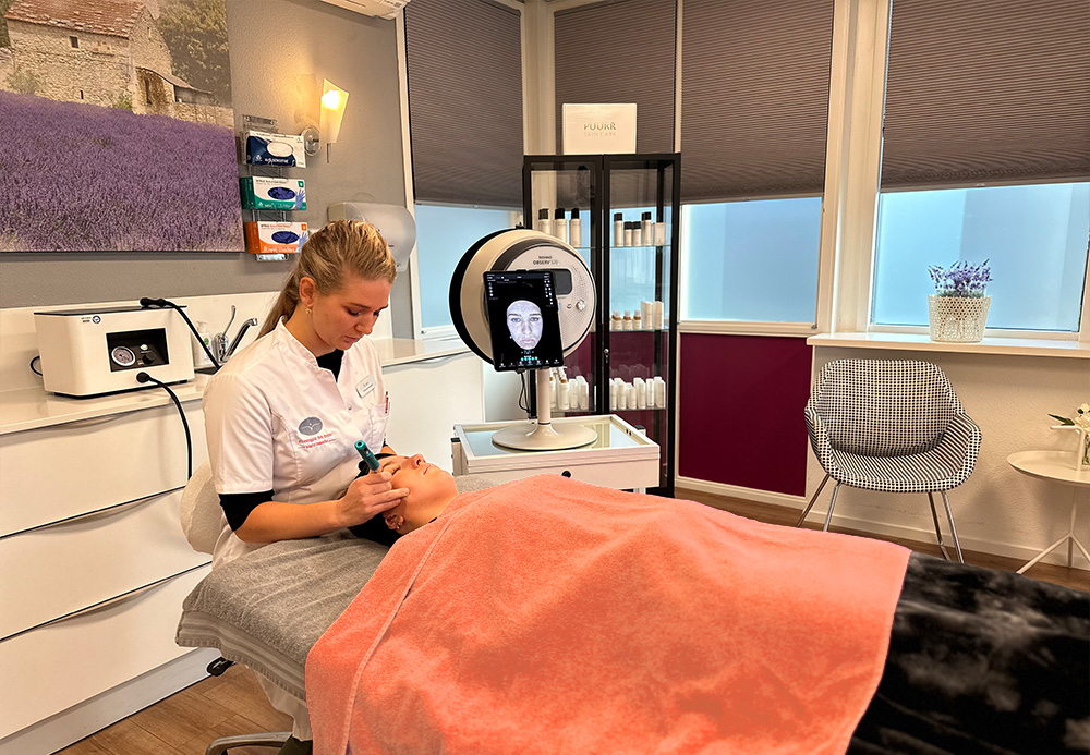 Microneedling en SoMe