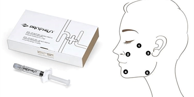 Een krachtige en bekroonde injectable: Profhilo®