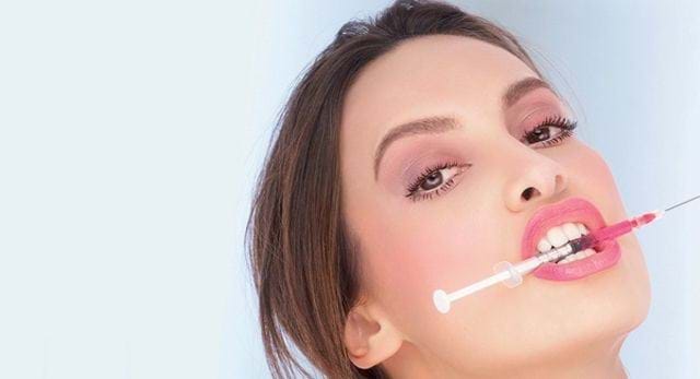 vampire facelift