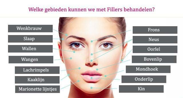 fillers gebieden