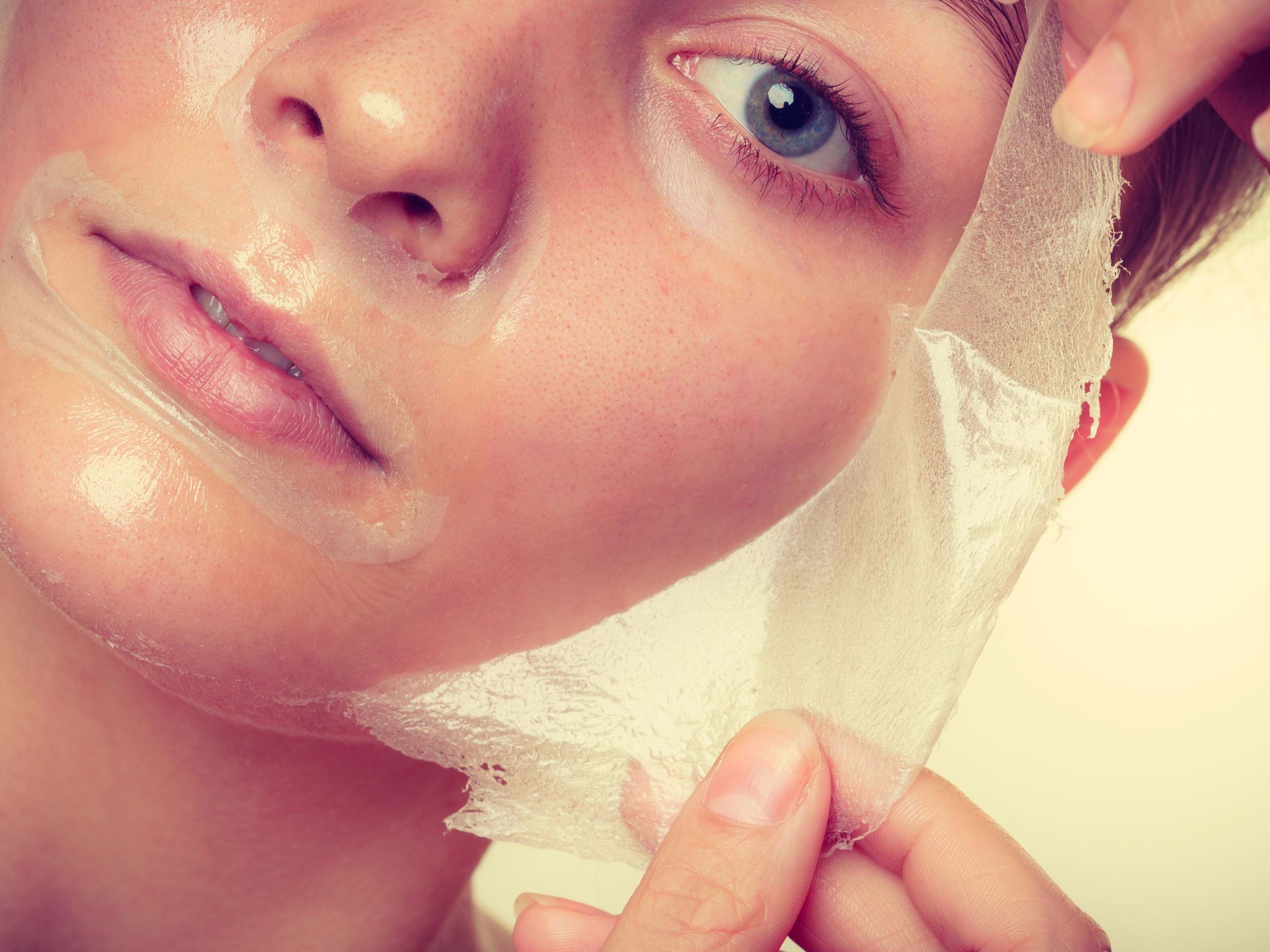 medische peelings