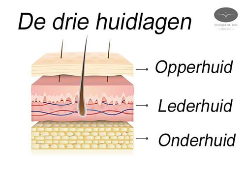 Vitamine A-zuur of behandeling