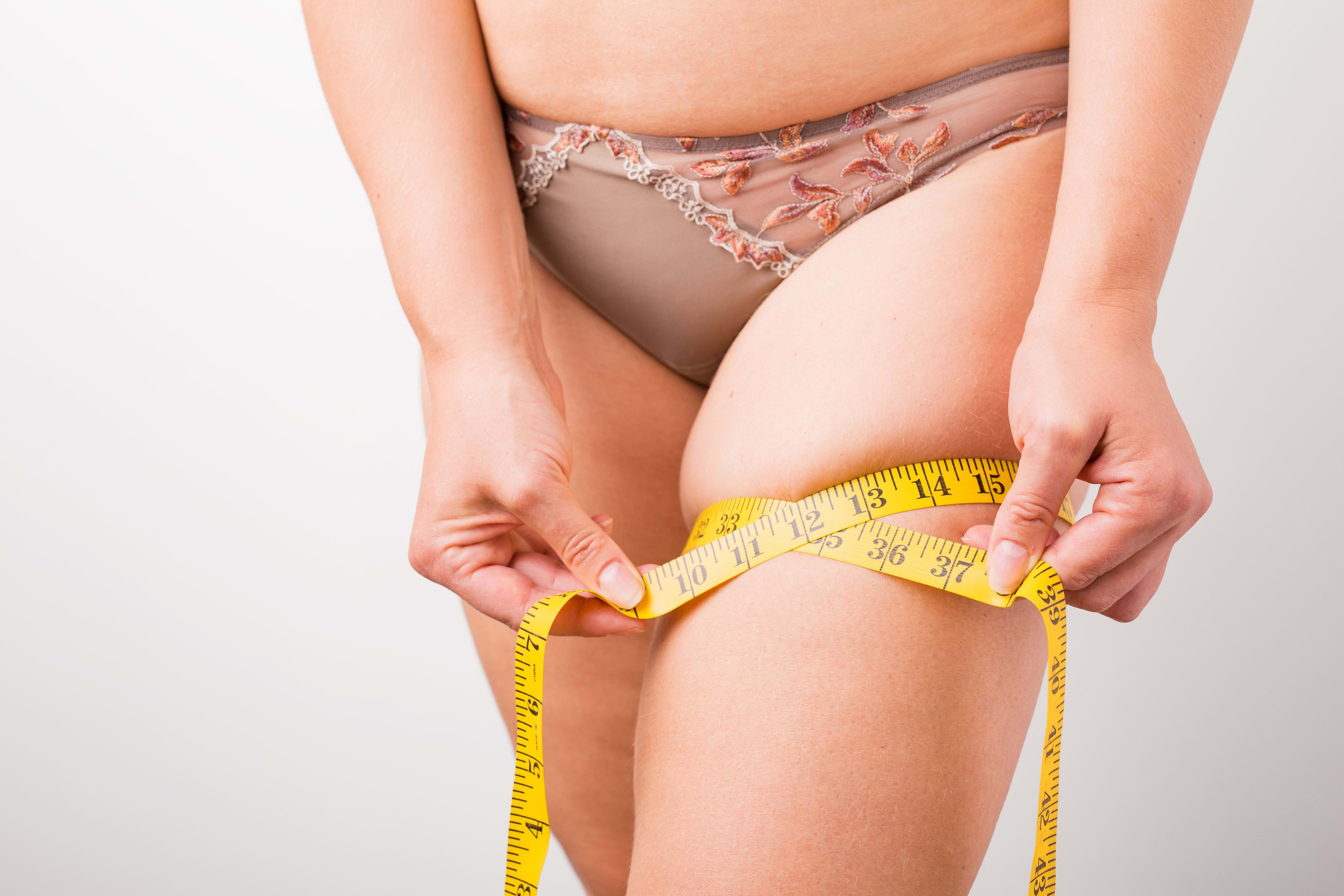 liposuctie benen